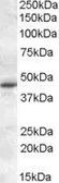 Anti-Melatonin Receptor 1A antibody, Internal used in Western Blot (WB). GTX31054