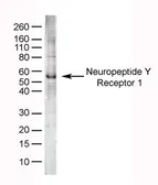 Anti-NPY1R antibody used in Western Blot (WB). GTX31073