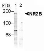Anti-NMDAR2B (phospho Tyr1252) antibody used in Western Blot (WB). GTX31084