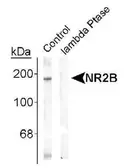 Anti-NMDAR2B (phospho Tyr1336) antibody used in Western Blot (WB). GTX31085