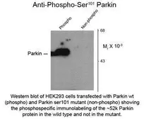 Anti-Parkin (phospho Ser101) antibody used in Western Blot (WB). GTX31094