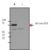 Anti-Huntingtin (neoepitope 513) antibody [3-19] used in Western Blot (WB). GTX31097