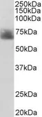 Anti-Serotonin Transporter antibody, Internal used in Western Blot (WB). GTX31103