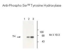 Anti-TPH2 (phospho Ser19) antibody used in Western Blot (WB). GTX31131