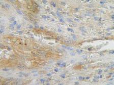 Anti-Fas Ligand antibody used in IHC (Paraffin sections) (IHC-P). GTX31191