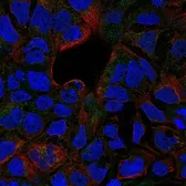 Anti-TNF Receptor II antibody used in Immunocytochemistry/ Immunofluorescence (ICC/IF). GTX31250