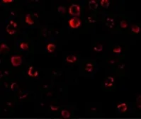 Anti-IRAK1 antibody used in Immunocytochemistry/ Immunofluorescence (ICC/IF). GTX31253