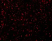 Anti-CCR3 antibody used in IHC (Paraffin sections) (IHC-P). GTX31254