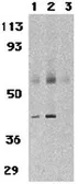 Anti-CCR3 antibody used in Western Blot (WB). GTX31255