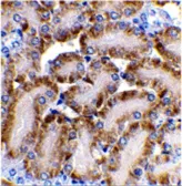 Anti-DFFB antibody used in IHC (Paraffin sections) (IHC-P). GTX31257