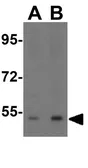 Anti-CX3CR1 antibody used in Western Blot (WB). GTX31260