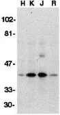 Anti-DFFB antibody used in Western Blot (WB). GTX31261