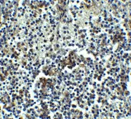 Anti-IRAK3 antibody used in IHC (Paraffin sections) (IHC-P). GTX31265