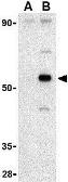 Anti-AVEN antibody used in Western Blot (WB). GTX31267
