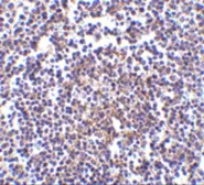 Anti-AVEN antibody used in IHC (Paraffin sections) (IHC-P). GTX31267