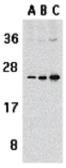 Anti-APRIL antibody used in Western Blot (WB). GTX31268