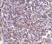 Anti-AVEN antibody used in IHC (Paraffin sections) (IHC-P). GTX31269