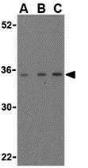 Anti-MAP1 antibody used in Western Blot (WB). GTX31275