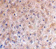 Anti-p53DINP1 antibody used in IHC (Paraffin sections) (IHC-P). GTX31278