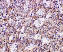 Anti-TLR2 antibody used in IHC (Paraffin sections) (IHC-P). GTX31279