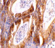 Anti-Bcl-G antibody used in IHC (Paraffin sections) (IHC-P). GTX31280
