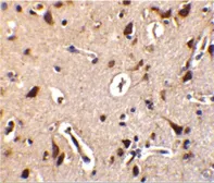 Anti-ALS2CR2 antibody used in IHC (Paraffin sections) (IHC-P). GTX31282