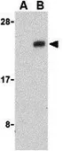 Anti-NADE antibody used in Western Blot (WB). GTX31283