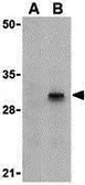 Anti-Caspase 8 antibody used in Western Blot (WB). GTX31285
