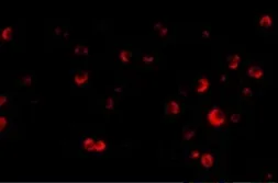Anti-TSC2 antibody used in Immunocytochemistry/ Immunofluorescence (ICC/IF). GTX31287
