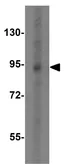 Anti-TLR3 antibody used in Western Blot (WB). GTX31291