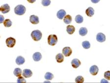 Anti-XBP1 antibody used in Immunocytochemistry/ Immunofluorescence (ICC/IF). GTX31292