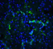 Anti-XBP1 antibody used in IHC (Paraffin sections) (IHC-P). GTX31293