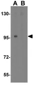 Anti-TLR9 antibody used in Western Blot (WB). GTX31295
