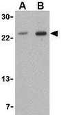 Anti-TNFRSF14 antibody used in Western Blot (WB). GTX31297