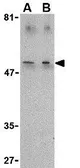 Anti-TIM-4 antibody used in Western Blot (WB). GTX31298