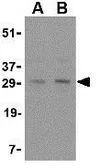 Anti-sRANKL antibody used in Western Blot (WB). GTX31300