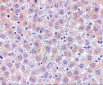 Anti-sRANKL antibody used in IHC (Paraffin sections) (IHC-P). GTX31300
