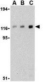 Anti-CBL antibody used in Western Blot (WB). GTX31301