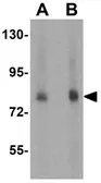 Anti-FAF1 antibody used in Western Blot (WB). GTX31302