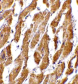 Anti-GPR44 antibody used in IHC (Paraffin sections) (IHC-P). GTX31303
