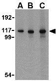 Anti-MDA5 antibody used in Western Blot (WB). GTX31304