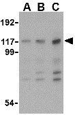 Anti-MDA5 antibody used in Western Blot (WB). GTX31305