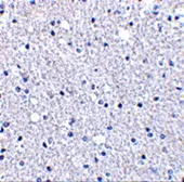 Anti-TIGAR antibody used in IHC (Paraffin sections) (IHC-P). GTX31306