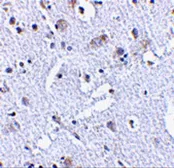 Anti-TIGAR antibody used in IHC (Paraffin sections) (IHC-P). GTX31307
