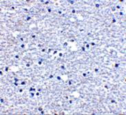 Anti-PD1 antibody used in IHC (Paraffin sections) (IHC-P). GTX31309