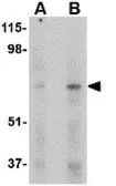 Anti-SIN1 antibody used in Western Blot (WB). GTX31312