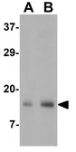 Anti-IEX1 antibody used in Western Blot (WB). GTX31315