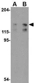 Anti-FYB antibody used in Western Blot (WB). GTX31318