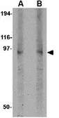 Anti-DISC1 antibody used in Western Blot (WB). GTX31319