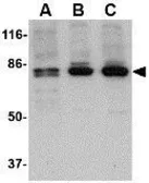 Anti-CCK4 antibody used in Western Blot (WB). GTX31322
